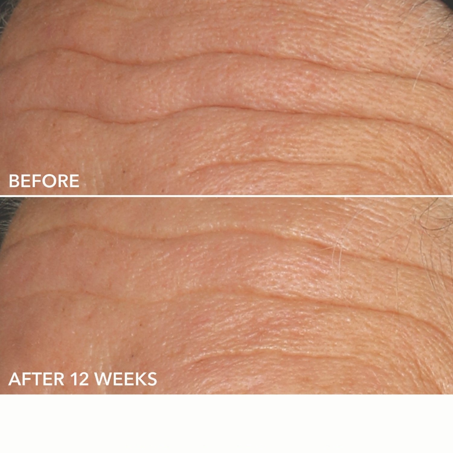 ALPHA BETA UNIVERSAL DAILY PEEL (ALMOHADILLAS EXFOLIANTES DIARIAS UNIVERSALES)